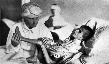 092. Ζωντανός σκελετός